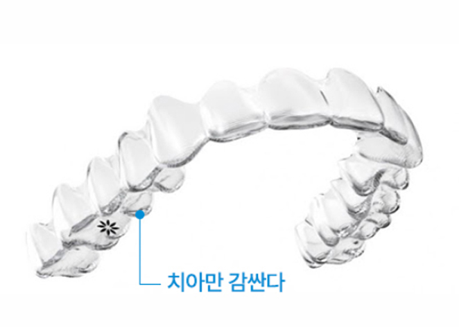 Invisalign