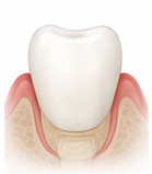 새 크라운 완성