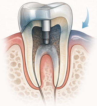 잇몸이 푸르게 보이는 현상